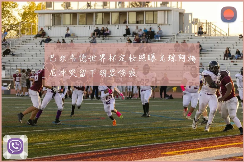 巴尔韦德世界杯定妆照曝光琼阿梅尼冲突留下明显伤痕